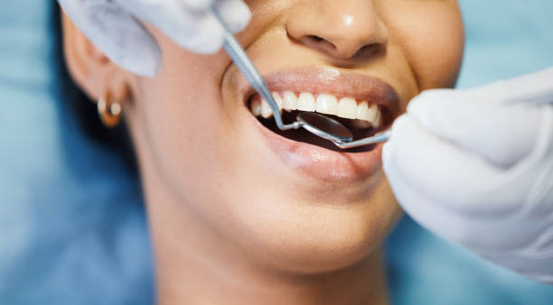 Best Same-Day Emergency Dental Services in Fountain, CO